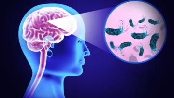 Woman Dies After Contracting Brain-Eating Amoeba from Tap Water Used in Nasal Rinse