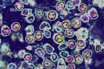Measles Tracking Wastewater: How Wastewater Monitoring Helps Track Measles Spread Across the US