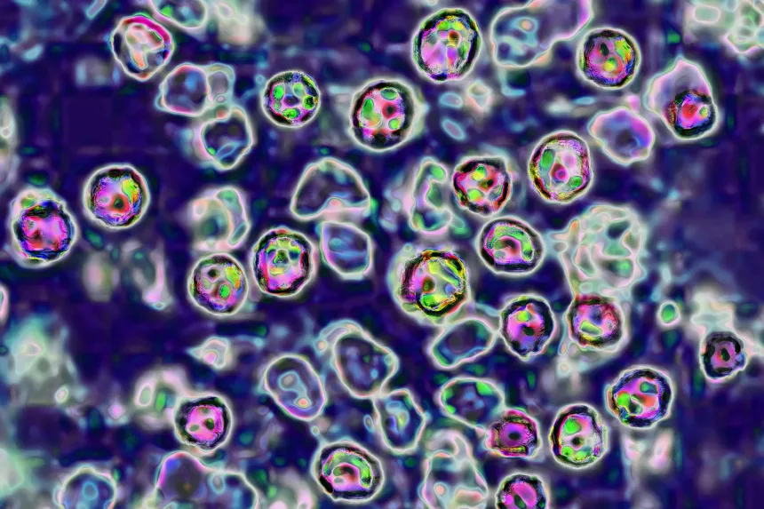measles tracking wastewater